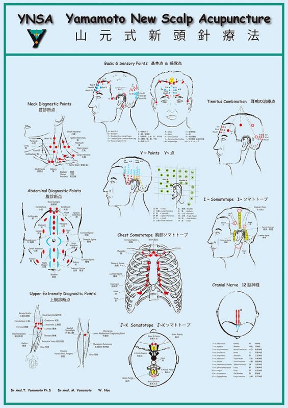 YNSAポスター - 山元式頭鍼療法(YNSA)特設販売ページ